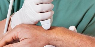 artrita ca cauză a durerii în articulațiile degetelor