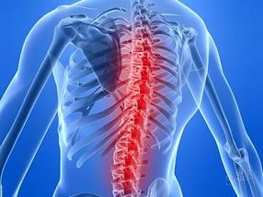 boala coloanei vertebrale cauzează dureri de spate