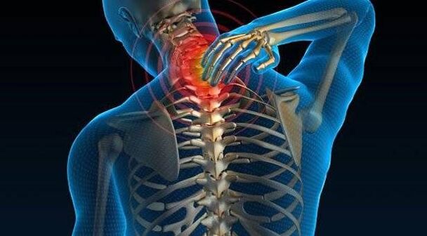 Osteocondrita coloanei vertebrale