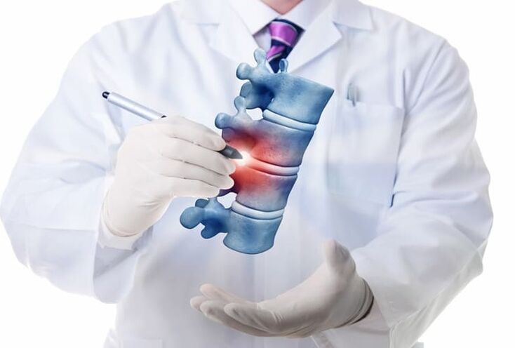 leziunea coloanei vertebrale în osteocondroza toracică